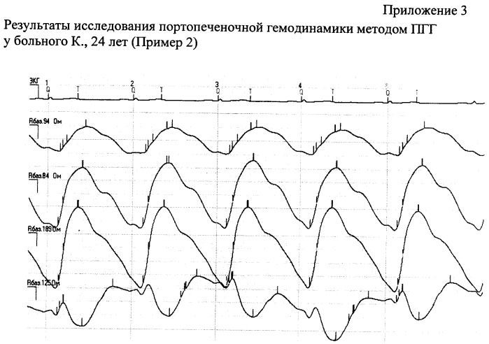 Способ оценки фиброза печени (патент 2453268)