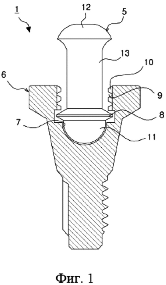 Фиксирующий узел крепления для зубного протеза (патент 2658158)