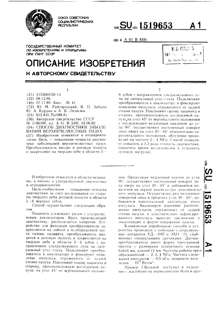 Способ диагностики заболеваний верхнечелюстных пазух (патент 1519653)