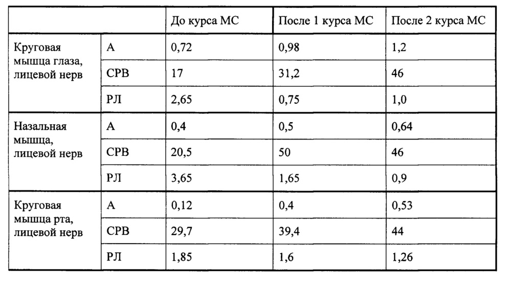 Способ восстановления функции нервов (патент 2662657)