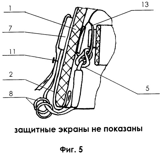 Защитный комплект для головы (патент 2392576)