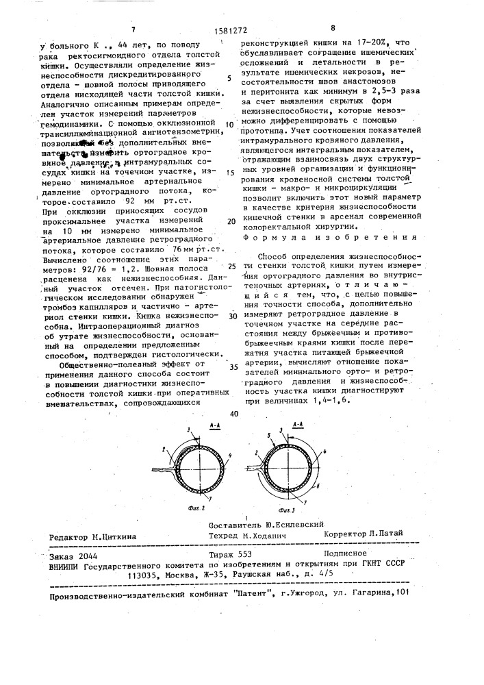 Способ определения жизнеспособности стенки толстой кишки (патент 1581272)