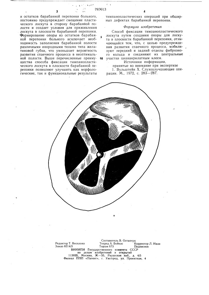 Способ фиксации тимпанопластического лоскута (патент 787013)