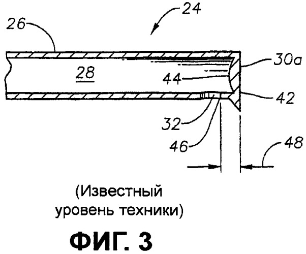 Зонд для витрэктомии (патент 2416383)