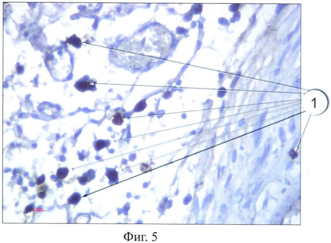 Клетка препараты. Тучные клетки гистология. Гистологический препарат тучные клетки. Тучные клетки препарат на микроскопе. Идентификация клеток это.