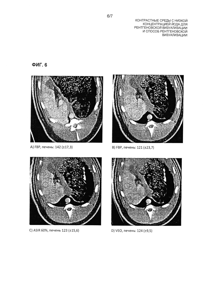 Контрастные среды с низкой концентрацией йода для рентгеновской визуализации и способ рентгеновской визуализации (патент 2664418)