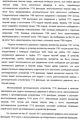 Система и способ продувки устройства пониженного давления во время лечения путем подачи пониженного давления (патент 2404822)