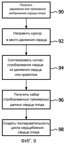 Формирование трехмерного изображения сердца плода посредством физиологически стробированного получения данных, не связанного с экг (патент 2539006)