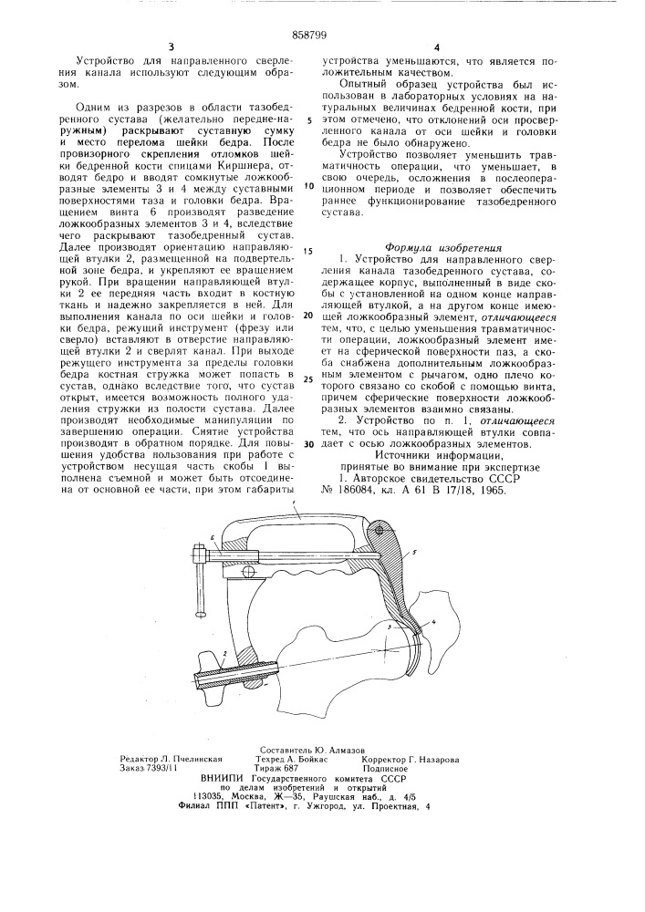 Устройство для направленного сверления канала тазобедренного сустава (патент 858799)