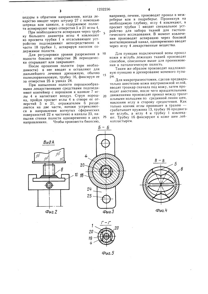 Троакар (патент 1232236)