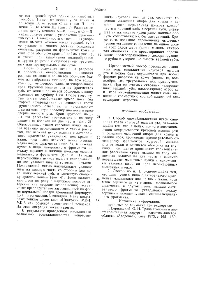 Способ миохейлопластики (патент 825029)