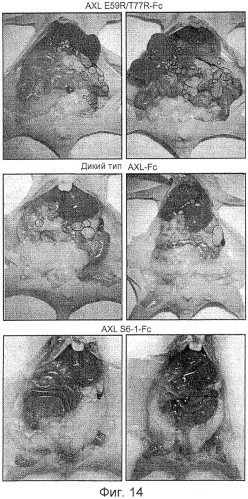Ингибирование axl сигнализации в антиметастатической терапии (патент 2556822)