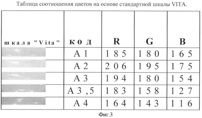 Способ комплексной оценки качества реставрации твердых тканей зуба (патент 2391935)