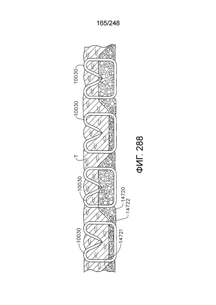 Кассета сшивающего инструмента, содержащая компенсатор толщины ткани, включающий отверстия (патент 2657850)