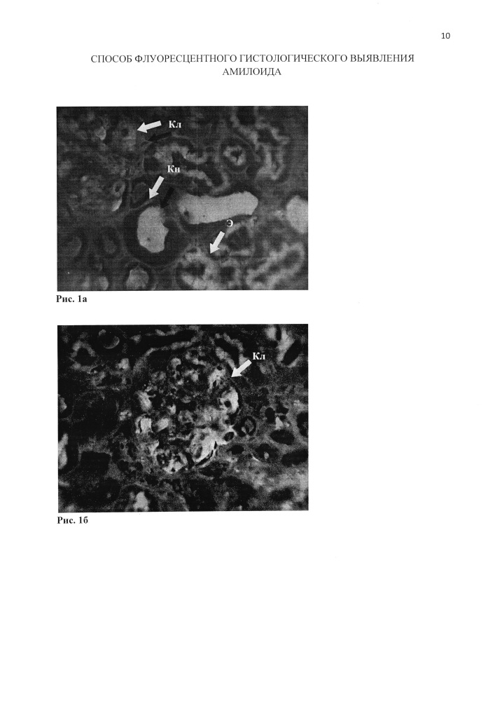 Способ флуоресцентного гистологического выявления амилоида (патент 2611408)
