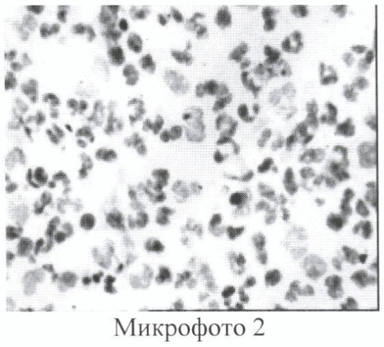 Композиция для лечения гнойных ран и трофических язв (патент 2384338)