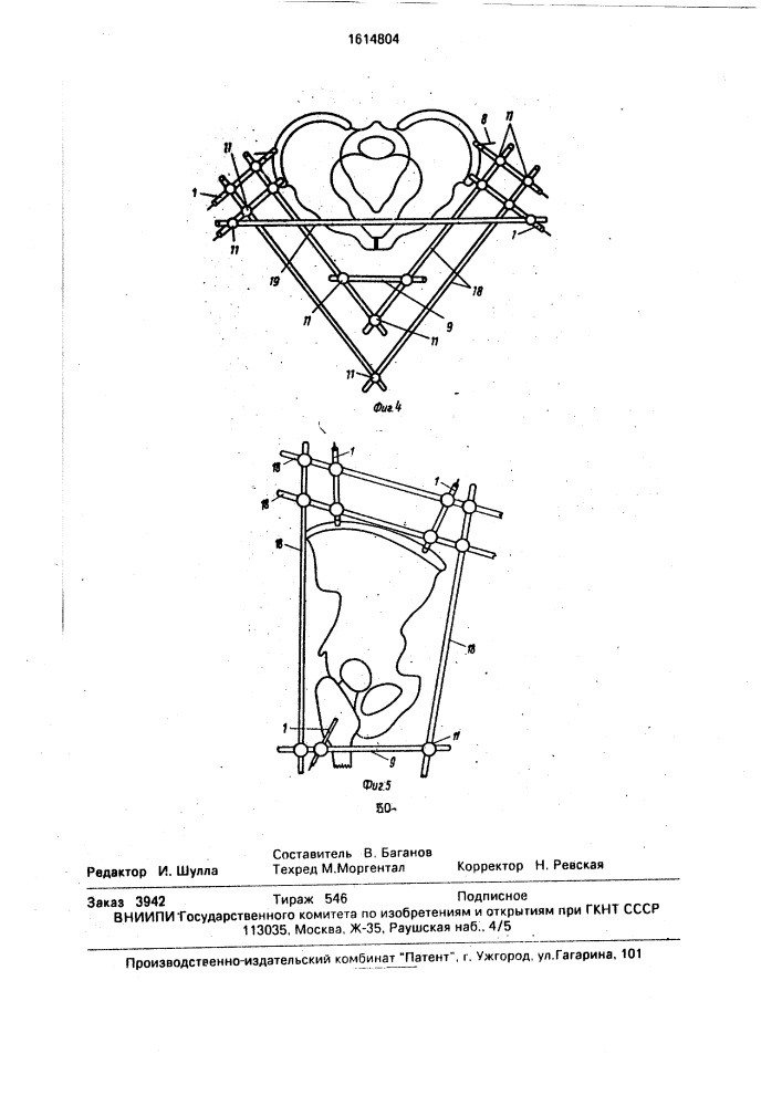 Устройство для репозиции и фиксации костей таза (патент 1614804)