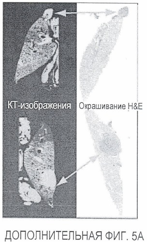 Ингибирование метастазов опухоли антителами против нейропилина-2 (патент 2437677)