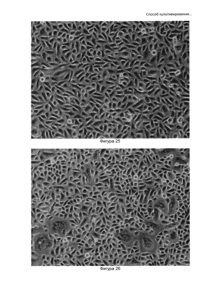 Способ культивирования клеток слюнной железы человека (патент 2631005)