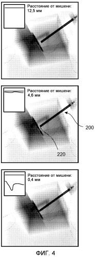 Повторная калибровка предварительно записанных изображений во время вмешательства с использованием игольчатого устройства (патент 2535605)