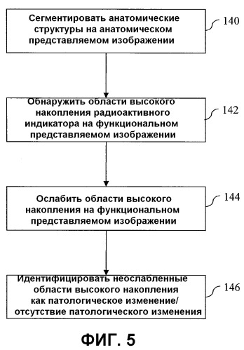 Построение анатомической модели для обозначения границ представляющей интерес опухолевой области (патент 2544479)