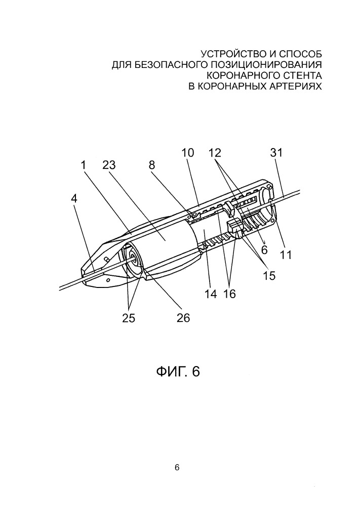 Устройство и способ для безопасного позиционирования коронарного стента в коронарных артериях (патент 2661092)
