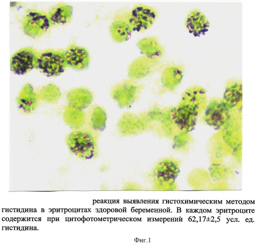 Способ определения гистидина в эритроцитах периферической крови, позволяющий определять степень оксигенации гемоглобина (патент 2533237)