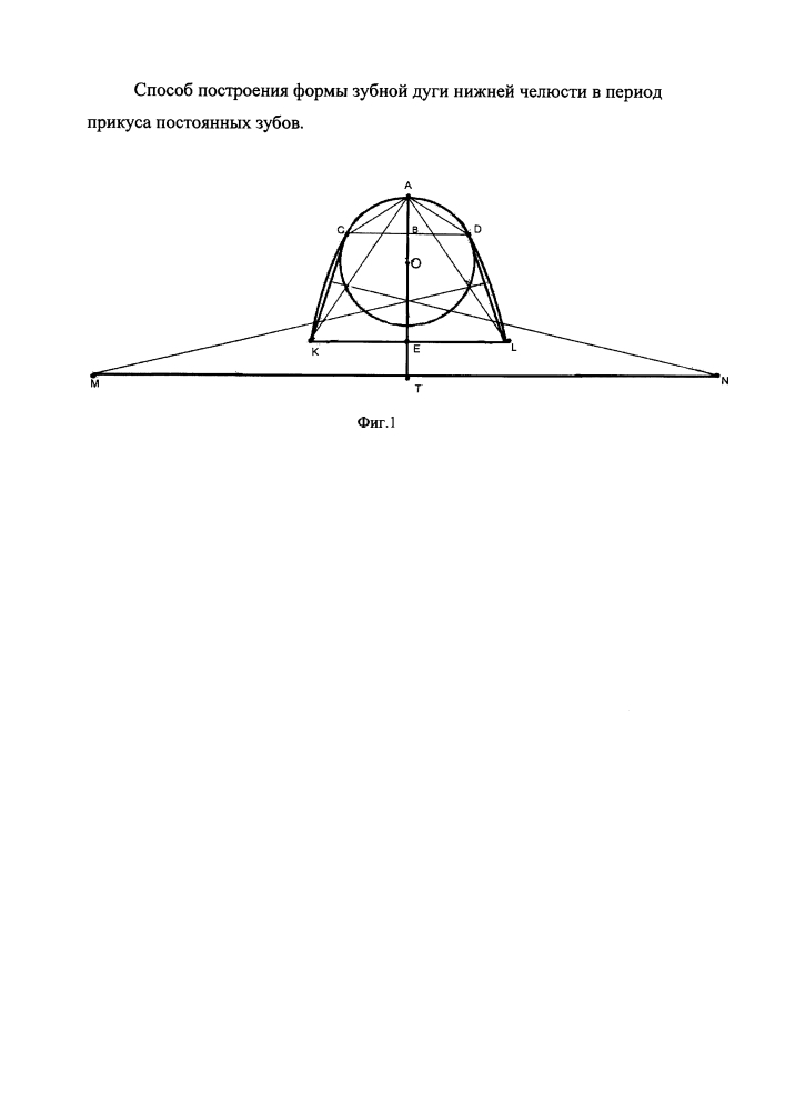 Способ построения формы зубной дуги нижней челюсти в период прикуса постоянных зубов (патент 2610860)