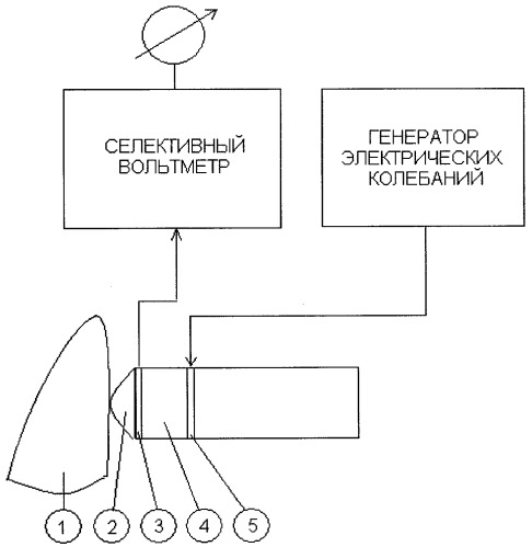 Способ определения степени тяжести пародонтита (патент 2286712)