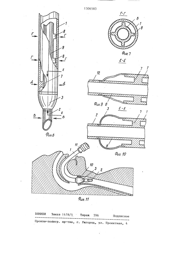 Трахеальная трубка (патент 1306583)
