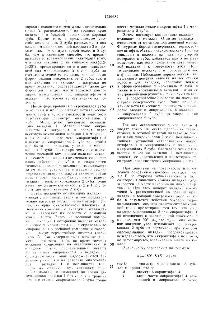 Способ восстановления коронки частичного стертого зуба (патент 1526682)