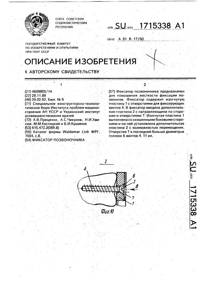 Фиксатор позвоночника (патент 1715338)