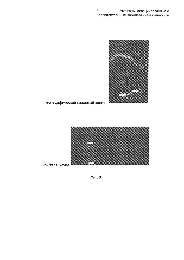 Антигены, ассоциированные с воспалительным заболеванием кишечника (патент 2612878)