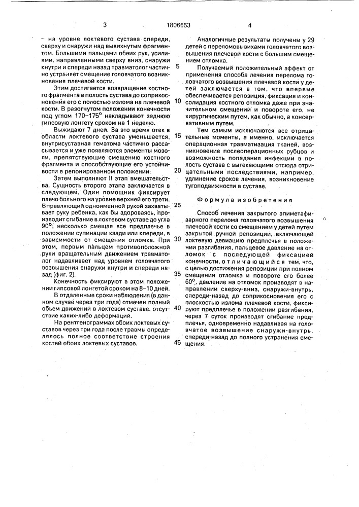 Способ лечения закрытого эпиметафизарного перелома головчатого возвышения плечевой кости со смещением у детей (патент 1806653)