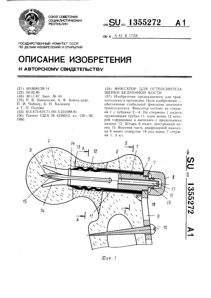 Фиксатор для остеосинтеза шейки бедренной кости (патент 1355272)