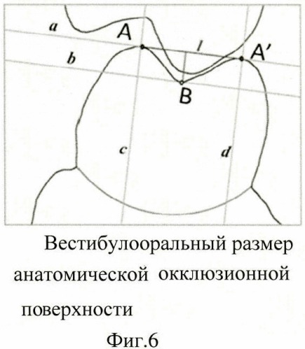 Способ измерения размеров зубов, зубных бугров и их внутренних и наружных скатов (патент 2438617)