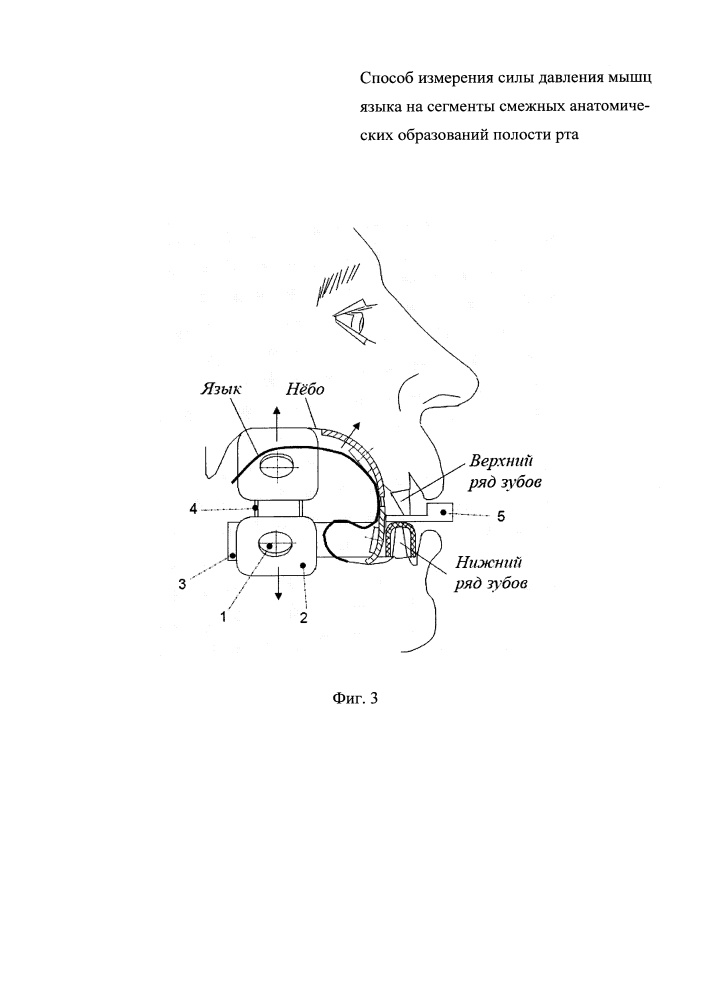 Способ измерения силы давления мышц языка на сегменты смежных анатомических образований полости рта (патент 2623309)