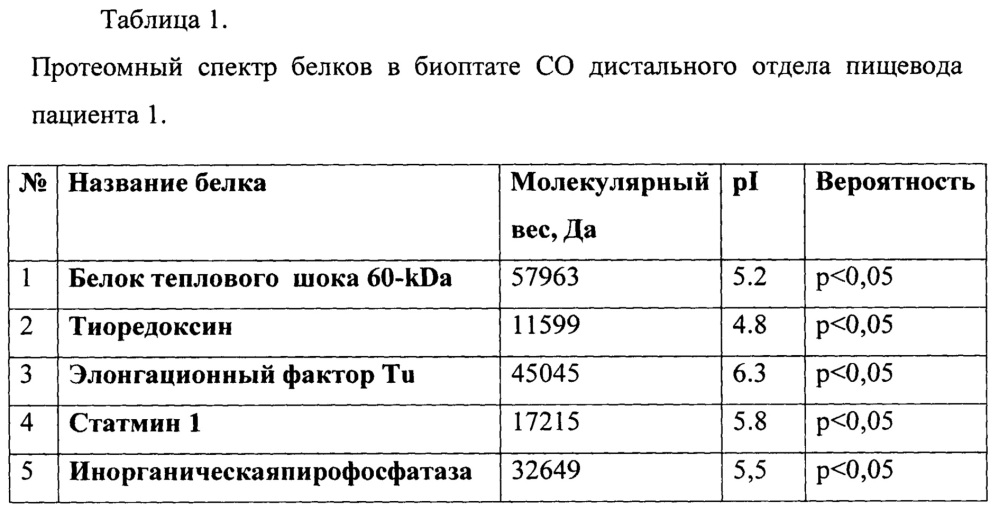 Способ диагностики пищевода барретта у больных с осложненным течением гастроэзофагеальной рефлюксной болезни (патент 2655807)