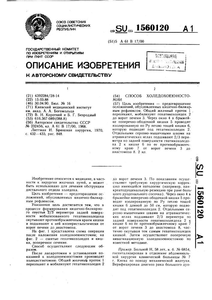 Способ холедохоеюностомии (патент 1560120)