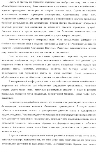 Стент из скользящих и блокирующих элементов (патент 2429801)
