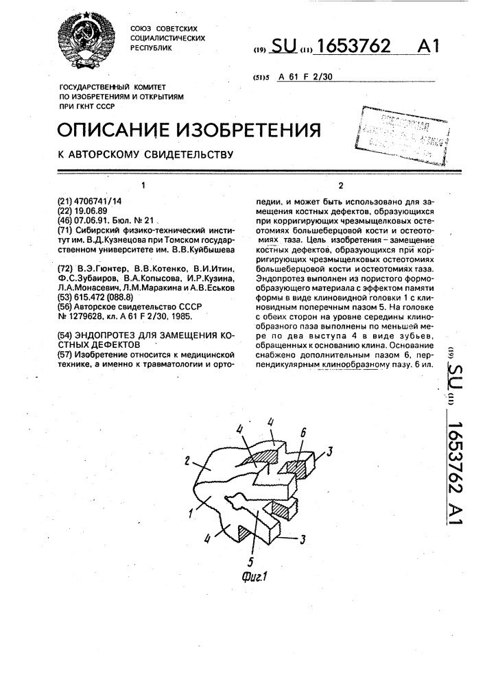 Эндопротез для замещения костных дефектов (патент 1653762)