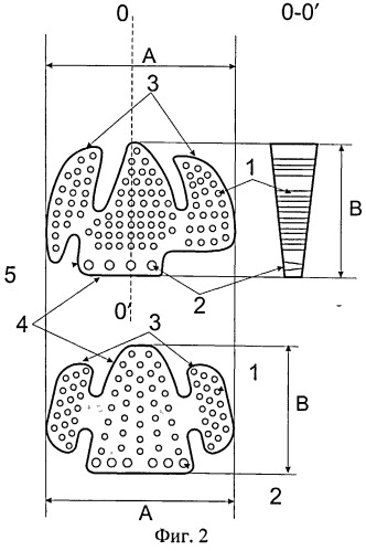 Пластина для пластики посттравматических дефектов и деформаций дна глазницы (патент 2512785)