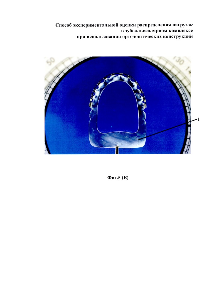 Способ экспериментальной оценки распределения нагрузок в зубоальвеолярном комплексе при использовании ортодонтических конструкций (патент 2618888)
