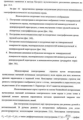 Способ неинвазивного электрофизиологического исследования сердца (патент 2417051)