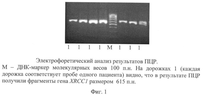 Способ определения предрасположенности человека к развитию агрессивных неходжкинских лимфом (патент 2373862)