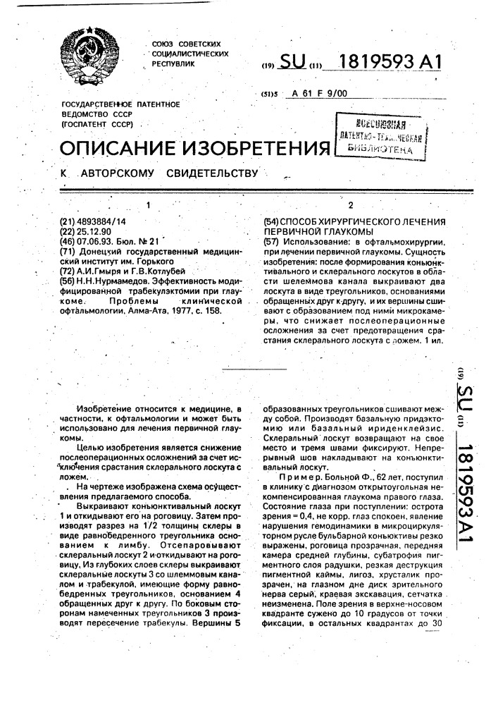 Способ хирургического лечения первичной глаукомы (патент 1819593)