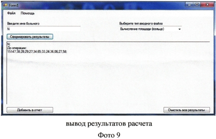 Способ динамического контроля за состоянием диска зрительного нерва при заболеваниях зрительного нерва. (патент 2556567)