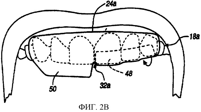 Лента-носитель для применения на поверхностях рта и относящиеся к ней способы (патент 2373898)