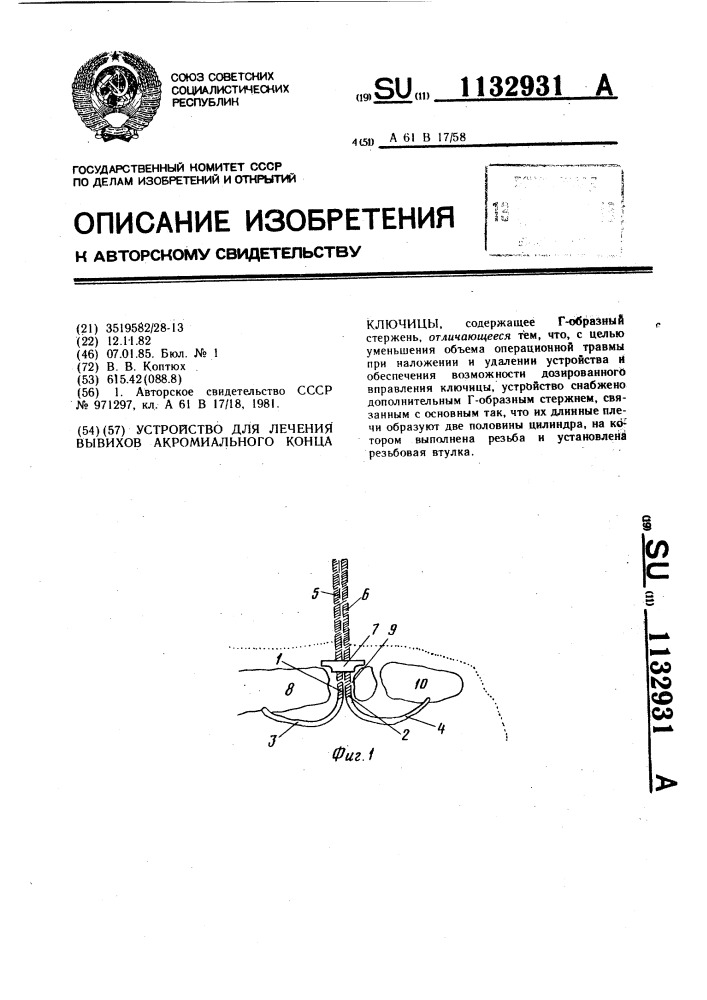 Устройство для лечения вывихов акромиального конца ключицы (патент 1132931)