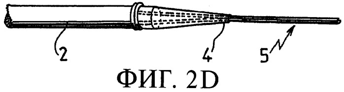 Способ крепления натяжных нитей к концам протезной связки (патент 2370243)